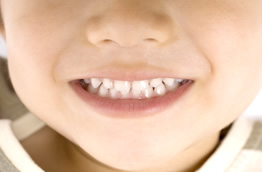 乳幼児期からの検診、歯のクリーニング